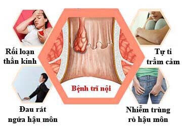 Tác hại của bệnh trĩ